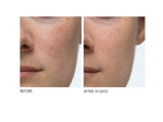 Dr Dennis Gross Alpha Beta Peel Extra Strength Pads X 3
