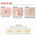 Korean - Cosrx, Acne Pimple Master Patch, 24 Patches